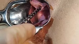 This time we finally used a speculum so you can see my urethra even better