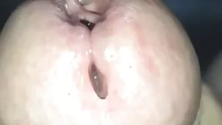 39 - Prollking Xxl - Playing With Long Foreskin