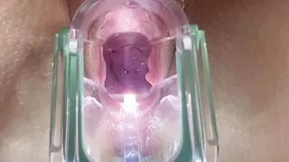 Stella St. Rose - Extreme Gaping, See my Cervix Close-Up using a Speculum