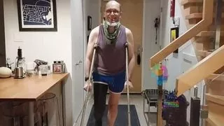 Long Leg Cast Adventure - Life in fiber from my thigh to my toes