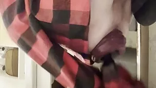 XL anal beads in prolapse