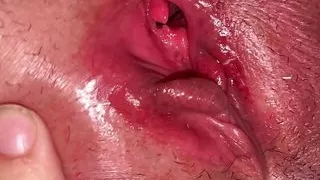 My Clictoris Is Swelling...find The Mole