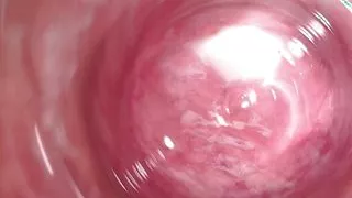 Internal Camera deep inside Mia's creamy pussy, Welcome to my vagina