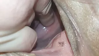 Cervix for Namsei (close-up)