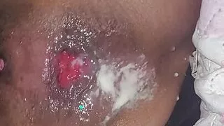 Maid does very open anal prolapse