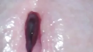 inserting the petrifying liquid into the large deep hole.