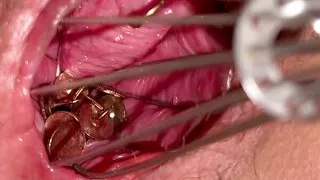 Put a thumbtack in your pussy and stir it with a whisk