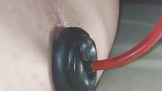 Balloon In Anal