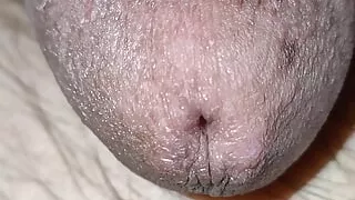 Penis video microscope closeup video