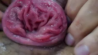 Fisting anal. Prolapse. Purchase plan.