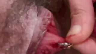 Stretched urethral mouth