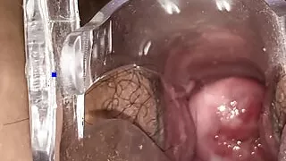 Cervical observation in Cusco