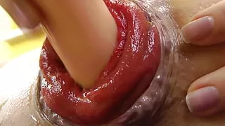 Sindy Rose Pump Her Anal Prolapse with Penis Pump & Fuck It with Shrimp Cock Dildo