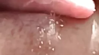 Sexy mouth complication
