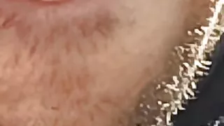 Salman and Katrina like mouth complication