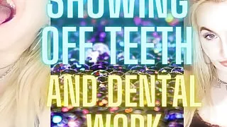 Showing off Teeth and Dental Work