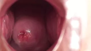 Young nurse gapes her pussy and shows her cervix through the speculum