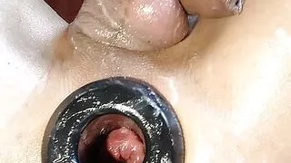 TUNNEL ANAL (psykoanal)