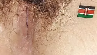 Nairobi anus