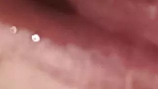 Sperm condom in MY mouth