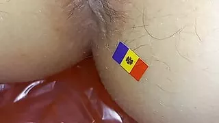 Chisinau Moldova anus
