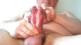 my beautiful subincision