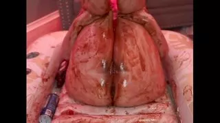 Making Myself into a Sundae