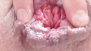 Pushing your cum from my used ass. Little prolapse rosebud POV
