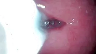 The camera in the penis shows the best picture of the male orgasm event