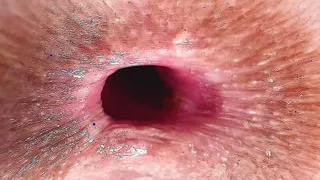 CUTE 19 years old GIRL VIRGIN ASS HEVER GOT DICK INSIDE!