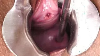 Extreme Cervix Penetration, Sounds, Speculum, Uterus Dilation