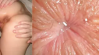 After pregnancy my tummy hangs like the skin of a Shar Pei but ass smells the same like vanilla