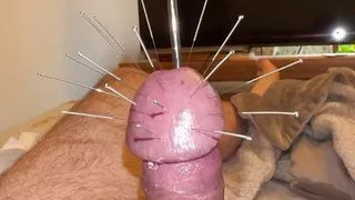 Estim and Acorn - Acupuncture!