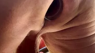 Jar disappears in ass