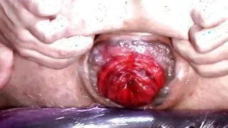 ANITACOX69 Anal Stuffing and Prolapse Pumping