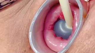 Inject Ink Deep Into My Uterus