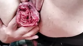 Anal Prolapsing and fisting my meaty wet asscunt