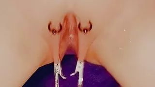 SklavinS stretching of labia