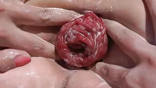 Proxy Paige Anal Fisting Destruction and Prolapse with Kinkyniky