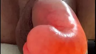 Glucose Saline Infusion