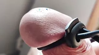 Using continuous electric current on the glans.