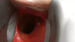 Sexy Blonde Nurse with Huge Speculum in Her Ass by Hotkinkyjo