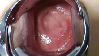 Hotkinkyjo Plastic Dress Xo Speculum Deep Self Fuck