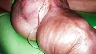 The 3th Liter Glucose