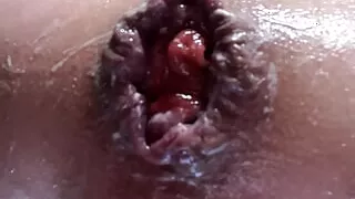 Stretched out anal ass cum
