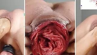 Selffist - fisting my ass - my new passion - rough anal self fisting - Prolapse & Rosebud