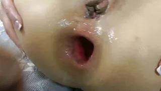 Hotkinkyjo Prolapse and Anal Fisting by Alexthorn