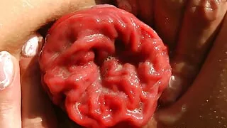 When the Dreams Come True Anal Fisting & Prolapse by Hotkinkyjo