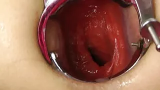 Xo Speculum and Long Dildo Fuck by Hotkinkyjo