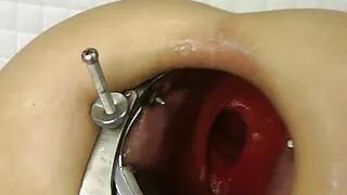 Deep Dildo in My Xo Open Ass by Hotkinkyjo